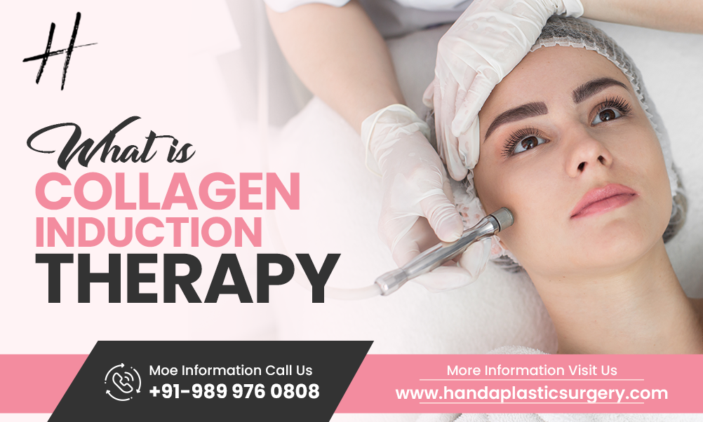 What Is Collagen Induction Therapy?