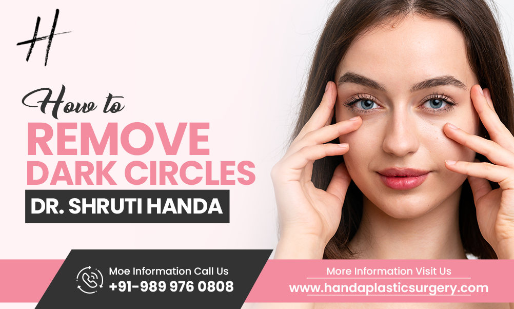 How To Remove Dark Circles – Expert Advice by Dr. Shruti Handa